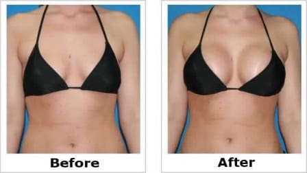 Breast Enlarging Cream_1